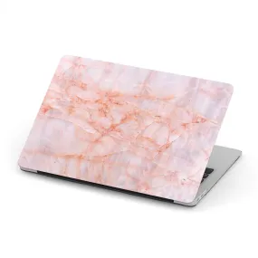 Macbook Hard Shell Case - Pink Granite